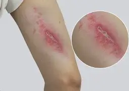 大坂直美赛况扑朔迷离球迷热议的简单介绍|mg游戏平台